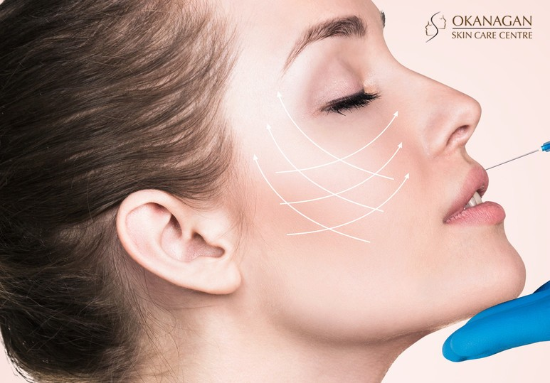 Kelowna Juvederm Anti-Aging Cosmetic Injectables