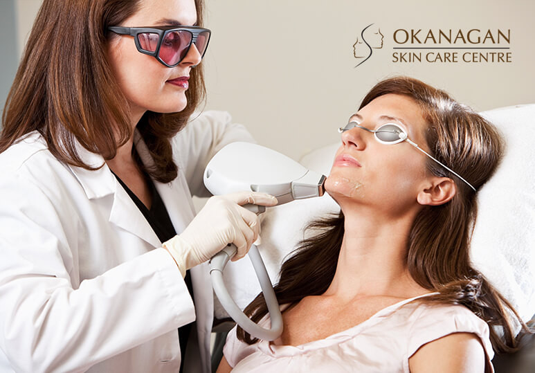 Okanagan Skin Care - blog - Laser Hair Removal Benefits