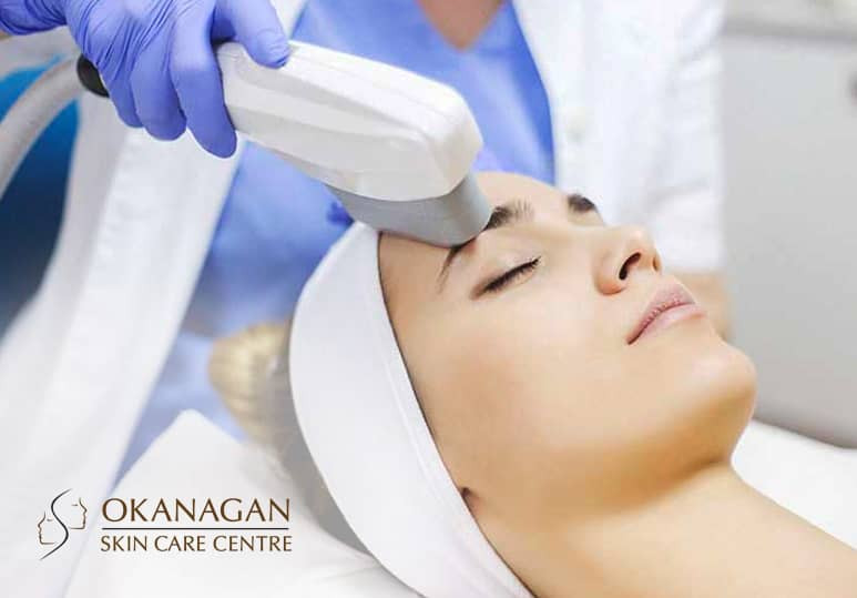Okanagan skin - Blog - How IPL Can Treat The Symptoms Of Rosacea