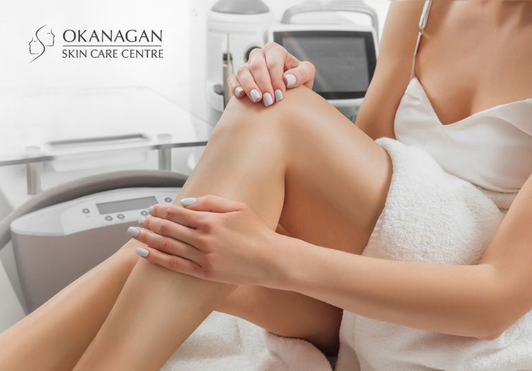 3 Reasons to Get Laser Hair Removal This Summer in Kelowna