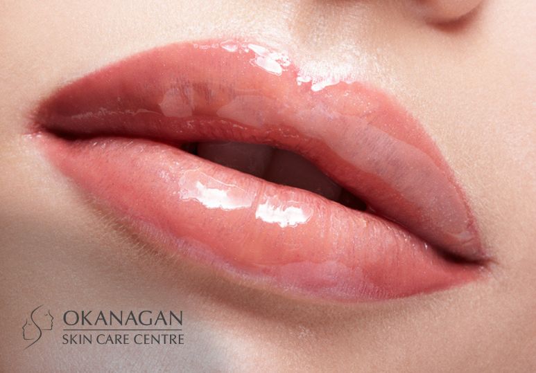 3 Tips for Choosing the Right Lip Enhancement Treatment in Kelowna