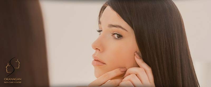 acne treatment kelowna